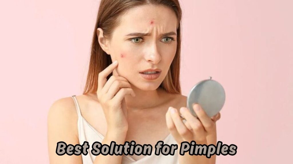 Best Solution for Pimples
