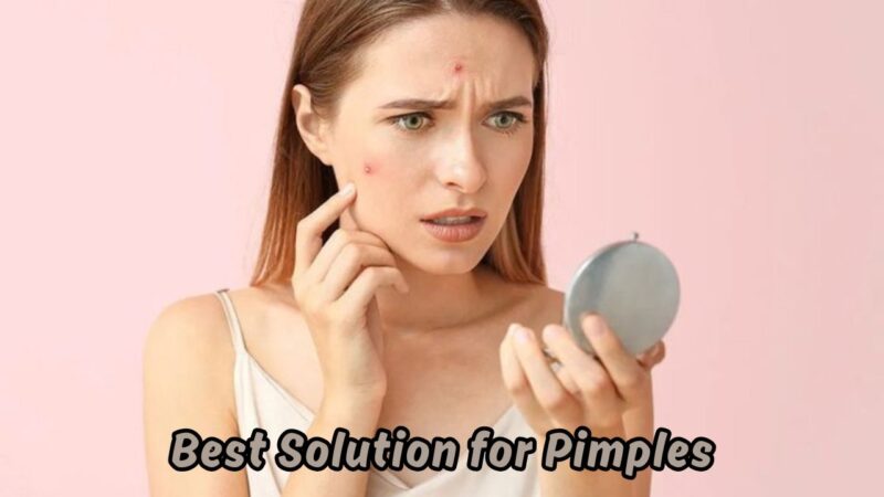 Best Solution for Pimples