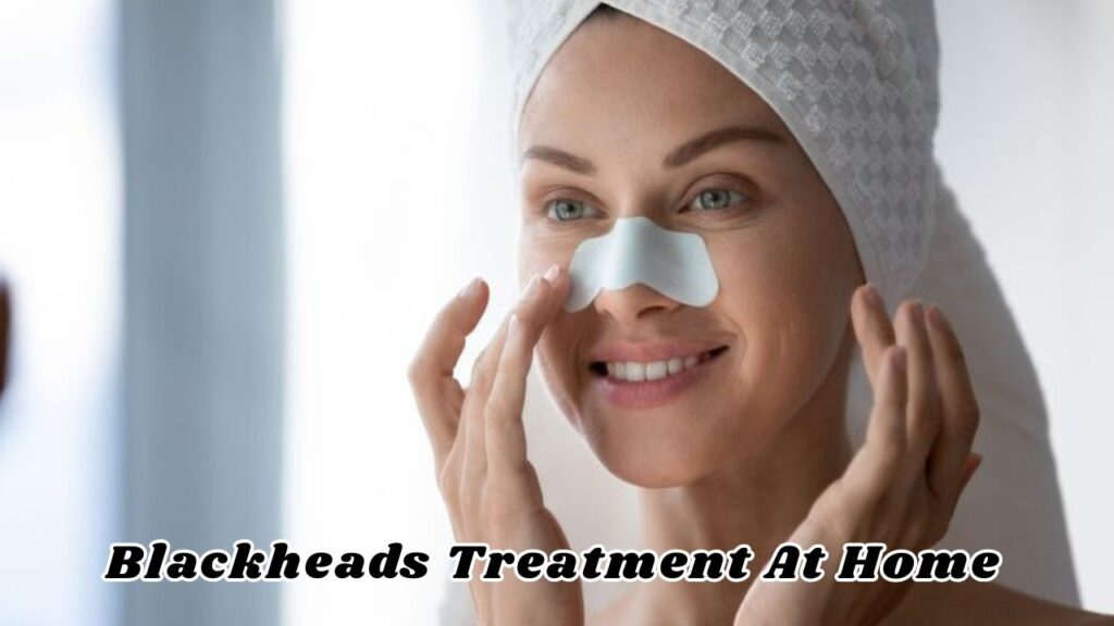 Blackheads Treatment at Home 