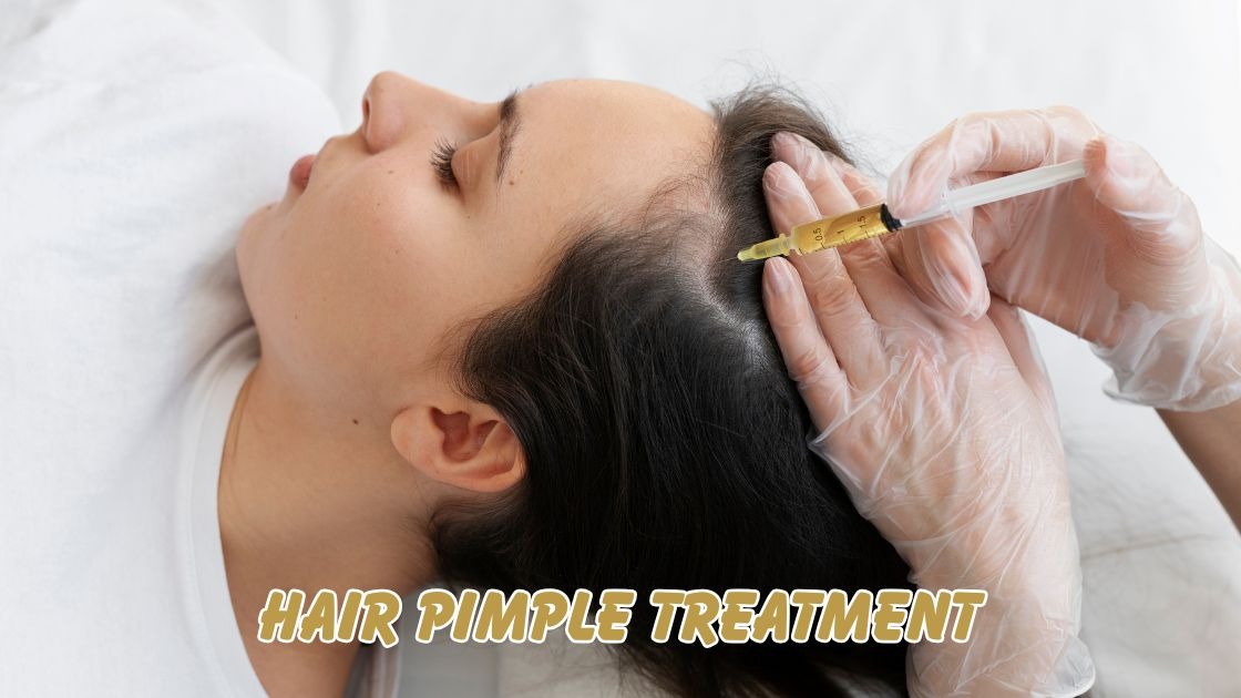 Hair Pimple Treatment