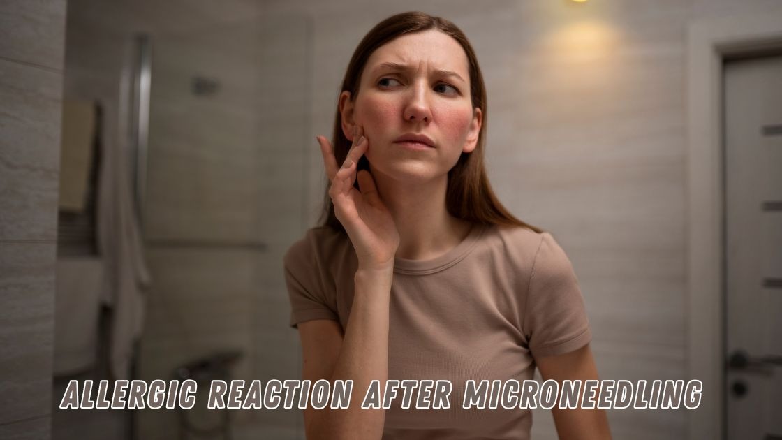 allergic reaction after microneedling