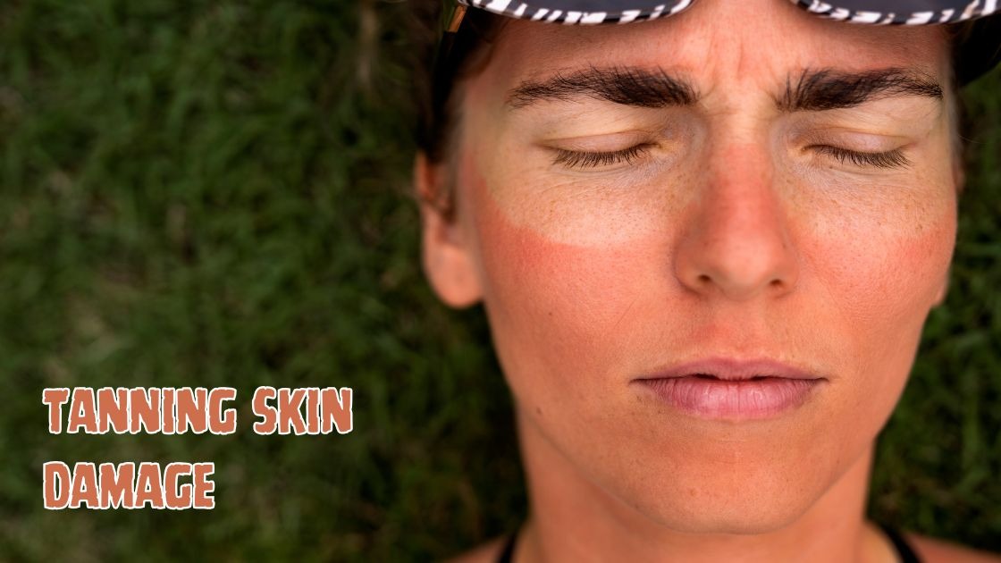 Tanning Skin Damage