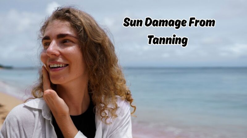 Sun Damage from Tanning