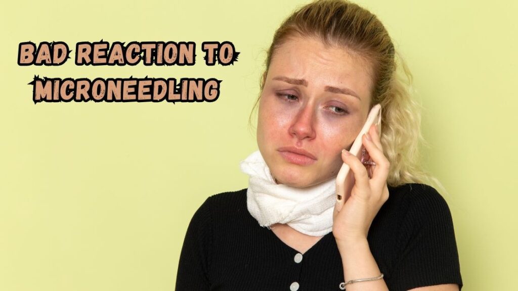 bad reaction to microneedling