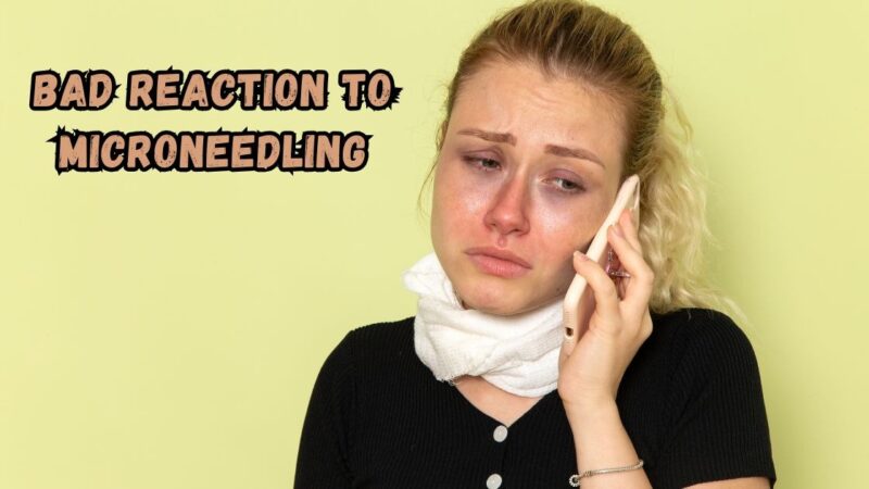 bad reaction to microneedling
