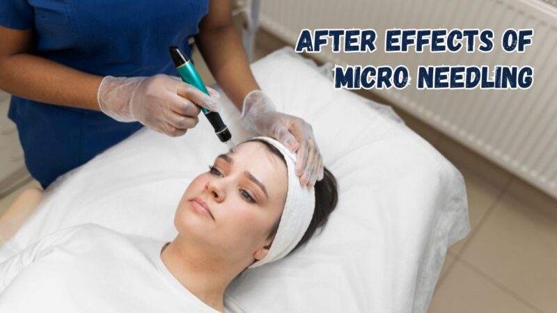 after effects of micro needling