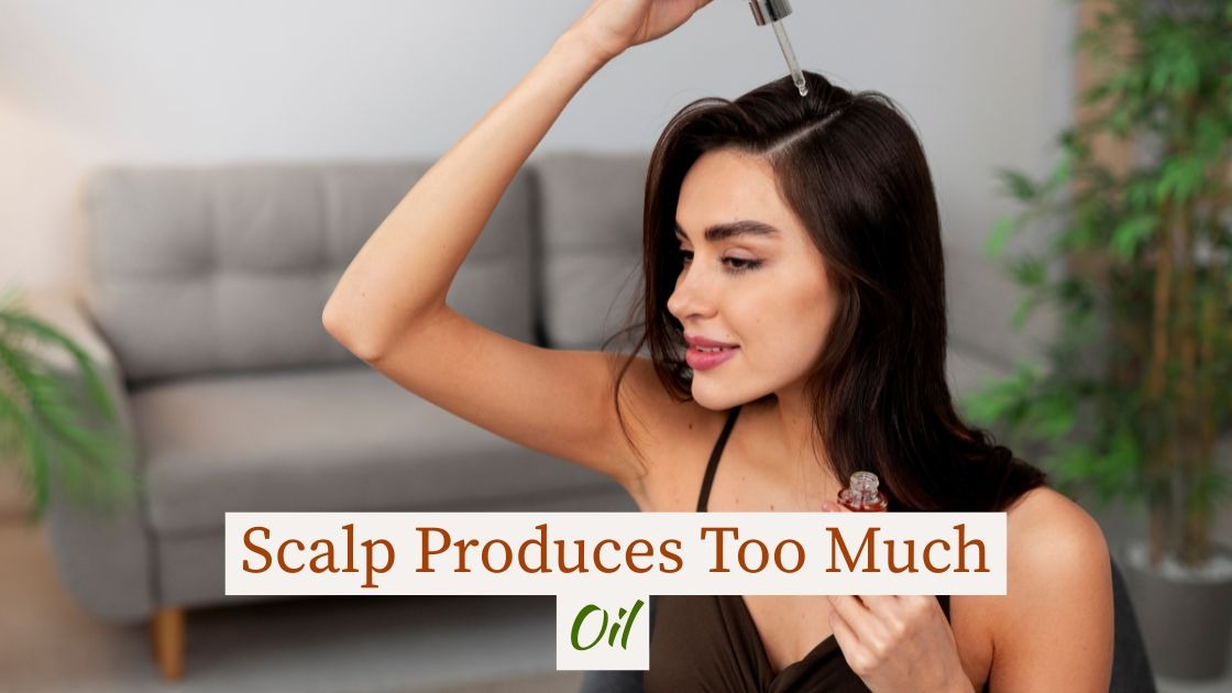 Scalp Produces Too Much Oil