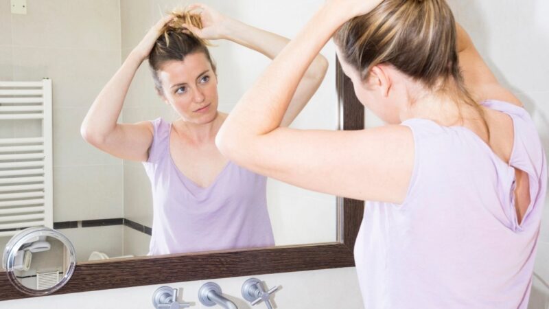 Seborrheic Dermatitis Waxy Hair
